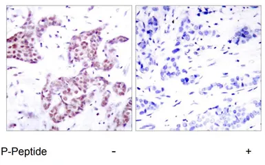 Anti-STAT6 (phospho Tyr641) antibody used in IHC (Paraffin sections) (IHC-P). GTX78935