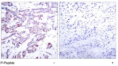 Anti-STAT6 (phospho Thr645) antibody used in IHC (Paraffin sections) (IHC-P). GTX78936