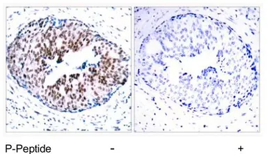 Anti-STAT5A (phospho Ser780) antibody used in IHC (Paraffin sections) (IHC-P). GTX78937