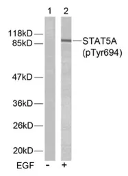 Anti-STAT5A (phospho Tyr694) antibody used in Western Blot (WB). GTX78938