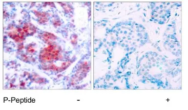 Anti-STAT4 (phospho Tyr693) antibody used in IHC (Paraffin sections) (IHC-P). GTX78939