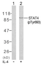 Anti-STAT4 (phospho Tyr693) antibody used in Western Blot (WB). GTX78939