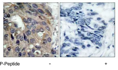 Anti-Src (phospho Tyr530) antibody used in IHC (Paraffin sections) (IHC-P). GTX78941