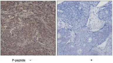 Anti-SMAD3 (phospho Ser425) antibody used in IHC (Paraffin sections) (IHC-P). GTX78942