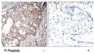 Anti-SHC1 (phospho Tyr317) antibody used in IHC (Paraffin sections) (IHC-P). GTX78947