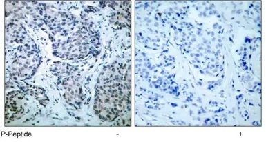 Anti-SEK1 / MKK4 (phospho Thr261) antibody used in IHC (Paraffin sections) (IHC-P). GTX78948