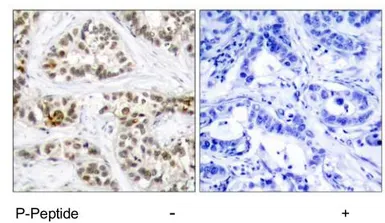 Anti-RelB (phospho Ser552) antibody used in IHC (Paraffin sections) (IHC-P). GTX78951