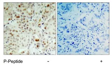 Anti-Rb (phospho Ser807) antibody used in IHC (Paraffin sections) (IHC-P). GTX78953