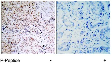 Anti-Rb (phospho Ser795) antibody used in IHC (Paraffin sections) (IHC-P). GTX78954