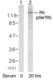 Anti-Rb (phospho Ser795) antibody used in Western Blot (WB). GTX78954