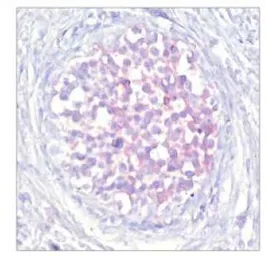 Anti-Raf1 (phospho Ser259) antibody used in IHC (Paraffin sections) (IHC-P). GTX78955