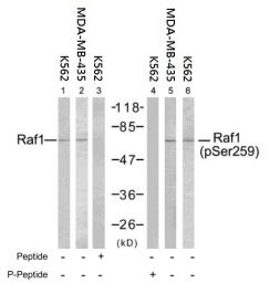 Anti-Raf1 (phospho Ser259) antibody used in Western Blot (WB). GTX78955