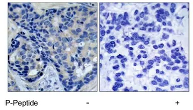 Anti-PYK2 (phospho Tyr402) antibody used in IHC (Paraffin sections) (IHC-P). GTX78958