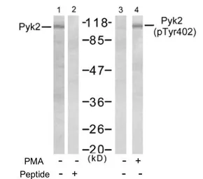 Anti-PYK2 (phospho Tyr402) antibody used in Western Blot (WB). GTX78958