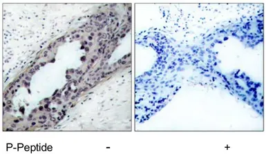 Anti-PTEN (phospho Ser380/Thr382/Thr383) antibody used in IHC (Paraffin sections) (IHC-P). GTX78959