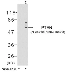 Anti-PTEN (phospho Ser380/Thr382/Thr383) antibody used in Western Blot (WB). GTX78959