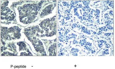 Anti-PLCG2 (phospho Tyr1217) antibody used in IHC (Paraffin sections) (IHC-P). GTX78961