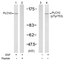 Anti-PLCG2 (phospho Tyr753) antibody used in Western Blot (WB). GTX78962