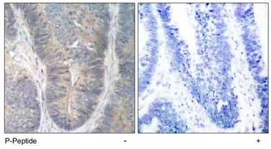 Anti-PKR (phospho Thr451) antibody used in IHC (Paraffin sections) (IHC-P). GTX78963