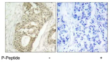Anti-PKC delta (phospho Ser645) antibody used in IHC (Paraffin sections) (IHC-P). GTX78968