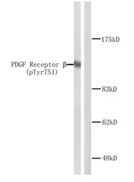 Anti-PDGF Receptor beta (phospho Tyr751) antibody used in Western Blot (WB). GTX78970
