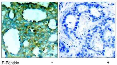 Anti-PAK1 (phospho Thr212) antibody used in IHC (Paraffin sections) (IHC-P). GTX78974