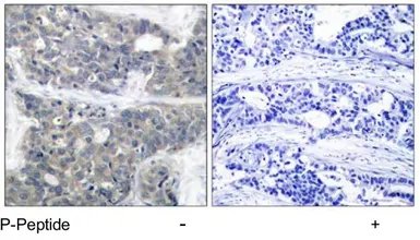 Anti-p70 S6K (phospho Thr421) antibody used in IHC (Paraffin sections) (IHC-P). GTX78979