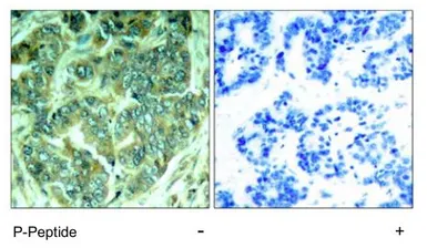 Anti-p62Dok (phospho Tyr398) antibody used in IHC (Paraffin sections) (IHC-P). GTX78980