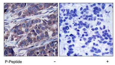Anti-p62Dok (phospho Tyr362) antibody used in IHC (Paraffin sections) (IHC-P). GTX78981