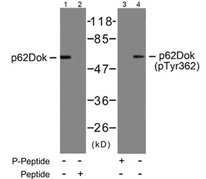 Anti-p62Dok (phospho Tyr362) antibody used in Western Blot (WB). GTX78981