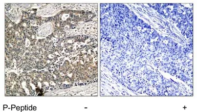 Anti-DOK2 (phospho Tyr299) antibody used in IHC (Paraffin sections) (IHC-P). GTX78982
