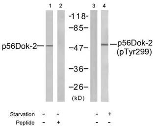 Anti-DOK2 (phospho Tyr299) antibody used in Western Blot (WB). GTX78982