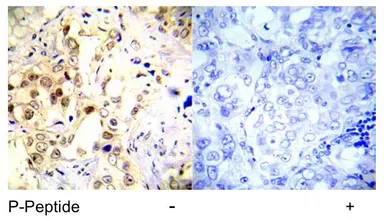 Anti-p53 (phospho Ser20) antibody used in IHC (Paraffin sections) (IHC-P). GTX78985