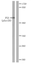 Anti-p53 (phospho Ser20) antibody used in Western Blot (WB). GTX78985