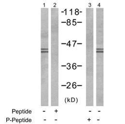 Anti-ERK1 (phospho Tyr204) + ERK2 (phospho Tyr187) antibody used in Western Blot (WB). GTX78987