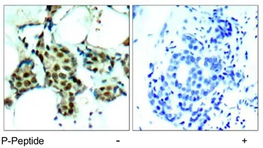Anti-p38 MAPK (phospho Tyr182) antibody used in IHC (Paraffin sections) (IHC-P). GTX78989