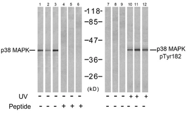 Anti-p38 MAPK (phospho Tyr182) antibody used in Western Blot (WB). GTX78989