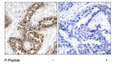 Anti-p21 Cip1 (phospho Thr145) antibody used in IHC (Paraffin sections) (IHC-P). GTX78992