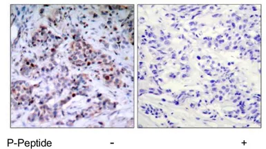 Anti-NFkB p65 (phospho Thr435) antibody used in IHC (Paraffin sections) (IHC-P). GTX78994