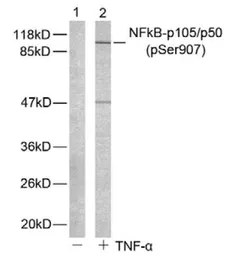 Anti-NFkB p105 (phospho Ser907) antibody used in Western Blot (WB). GTX78998