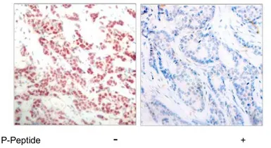 Anti-NFkB p100 (phospho Ser865) antibody used in IHC (Paraffin sections) (IHC-P). GTX79000
