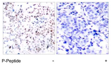 Anti-c-Myc (phospho Thr358) antibody used in IHC (Paraffin sections) (IHC-P). GTX79006