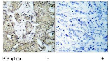 Anti-MEK3 (phospho Ser189) antibody used in IHC (Paraffin sections) (IHC-P). GTX79010