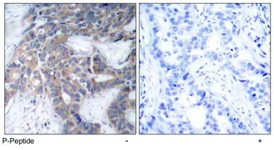 Anti-MEK1 (phospho Ser217) antibody used in IHC (Paraffin sections) (IHC-P). GTX79015