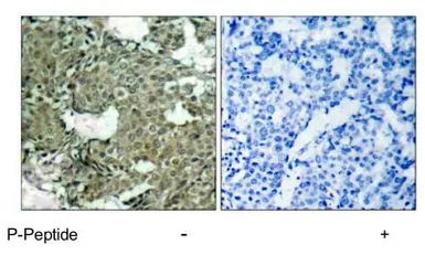 Anti-MEK1 (phospho Ser221) antibody used in IHC (Paraffin sections) (IHC-P). GTX79016
