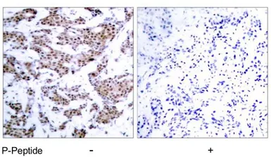 Anti-MEF2A (phospho Thr312) antibody used in IHC (Paraffin sections) (IHC-P). GTX79019