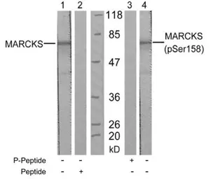 Anti-MARCKS (phospho Ser152) antibody used in Western Blot (WB). GTX79020