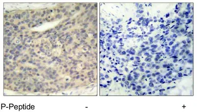 Anti-LIMK1 (phospho Thr508) + LIMK2 (phospho Thr505) antibody used in IHC (Paraffin sections) (IHC-P). GTX79023
