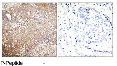Anti-Cytokeratin 18 (phospho Ser33) antibody used in IHC (Paraffin sections) (IHC-P). GTX79025