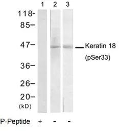 Anti-Cytokeratin 18 (phospho Ser33) antibody used in Western Blot (WB). GTX79025